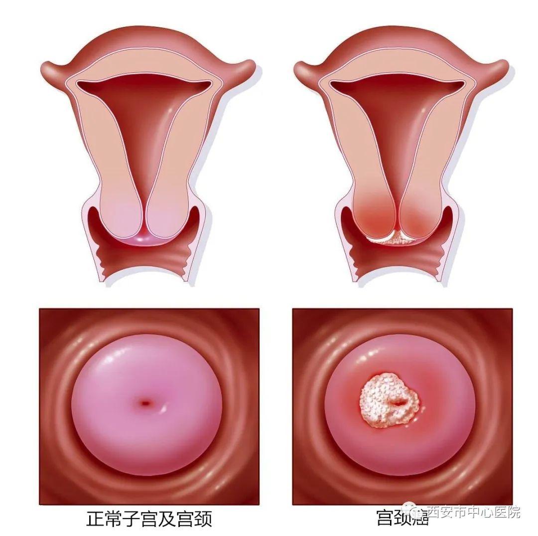 阴道出血半个月，了解、应对与关注