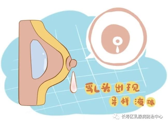 孕四个月乳头流水，解读孕期生理现象