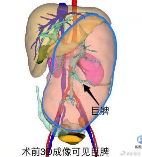 14个月宝宝贫血食谱，营养搭配与辅食建议